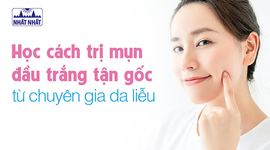 Học cách trị mụn đầu trắng tận gốc từ chuyên gia da liễu