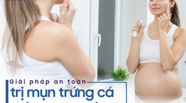 Giải pháp dùng thuốc an toàn để trị mụn trứng cá khi mang thai