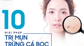 10 Giải pháp trị mụn trứng cá bọc tại nhà hiệu quả và đơn giản