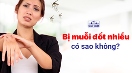 Lời giải cho câu hỏi: Bị muỗi đốt nhiều có sao không? 