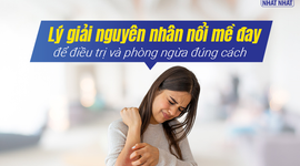Lý giải nguyên nhân nổi mề đay để điều trị và phòng ngừa đúng cách