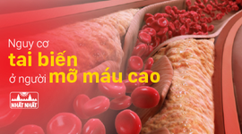 Nhận biết sớm nguy cơ tai biến ở người mỡ máu cao
