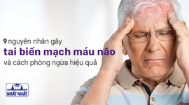 Nhận biết 9 nguyên nhân gây tai biến mạch máu não và cách phòng ngừa hiệu quả