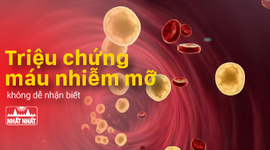 Xác định các triệu chứng bệnh máu nhiễm mỡ để điều trị chính xác