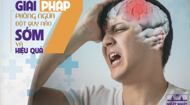 7 Giải pháp phòng ngừa đột quỵ não sớm và hiệu quả