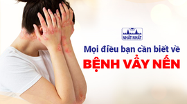 Mọi điều bạn cần biết về bệnh vẩy nến
