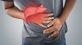Những dấu hiệu viêm gan nhiễm độc cần giải độc gan ngay