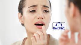 Giải đáp: Nhiệt lưỡi uống thuốc gì nhanh khỏi?