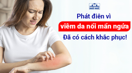 Phát điên vì viêm da nổi mẩn ngứa: đã có cách khắc phục!