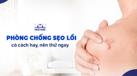 Phòng chống sẹo lồi: có cách hay, nên thử ngay !