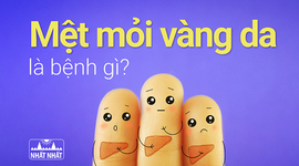 Mệt mỏi vàng da là bệnh gì, chữa thế nào?