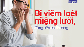 Bị viêm loét miệng lưỡi, đừng nên coi thường!