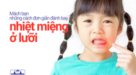 Mách bạn những cách đơn giản đánh bay nhiệt miệng ở lưỡi