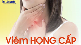 Viêm họng cấp: nên uống thuốc ngay hay chờ tự khỏi?