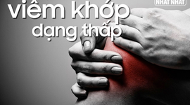 Biến chứng nguy hiểm của bệnh viêm khớp dạng thấp 