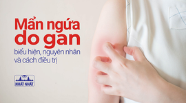 Mẩn ngứa do gan: biểu hiện, nguyên nhân và cách điều trị