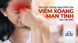 Các biến chứng nguy hiểm của viêm xoang mạn tính bạn cần biết 