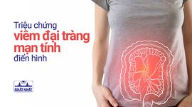 Những triệu chứng viêm đại tràng mạn tính điển hình, dễ nhận biết