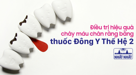 Điều trị hiệu quả chảy máu chân răng bằng thuốc Đông Y Thế Hệ 2