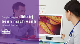 Các phương pháp điều trị bệnh mạch vành hiệu quả thực sự
