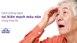 Cách phòng ngừa tai biến mạch máu não trong mùa hè