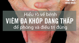 Hiểu rõ về bệnh viêm đa khớp dạng thấp để phòng và điều trị đúng