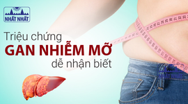 Những triệu chứng gan nhiễm mỡ điển hình, dễ nhận biết 