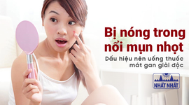 Bị nóng trong, nổi mụn nhọt – Dấu hiệu nên uống thuốc mát gan giải độc
