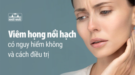 Tìm hiểu viêm họng nổi hạch có nguy hiểm không và cách điều trị