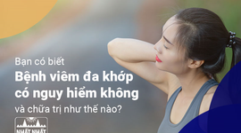 Bạn có biết “Bệnh viêm đa khớp có nguy hiểm không và chữa trị như thế nào?”