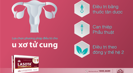 Lựa chọn phương pháp điều trị u xơ tử cung phù hợp