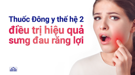 THUỐC ĐÔNG Y THẾ HỆ 2 KACHITA: Điều trị hiệu quả đau răng sưng lợi, chảy máu chân răng, hôi miệng