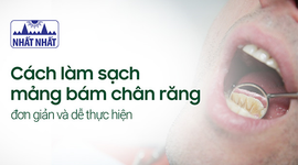 Cách làm sạch mảng bám chân răng đơn giản và dễ thực hiện