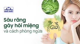Sâu răng gây hôi miệng như thế nào và cách phòng ngừa hiệu quả