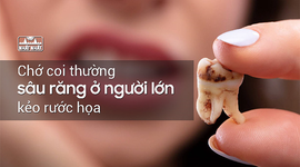 Chớ coi thường sâu răng ở người lớn kẻo rước họa!