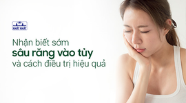 Nhận biết sớm sâu răng vào tủy và cách điều trị hiệu quả