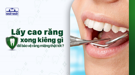 Lấy cao răng xong kiêng gì để bảo vệ răng miệng thật tốt?