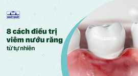 Tiết lộ ngay 8 cách điều trị viêm nướu răng từ tự nhiên