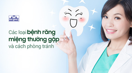 Các loại bệnh răng miệng thường gặp và cách phòng tránh
