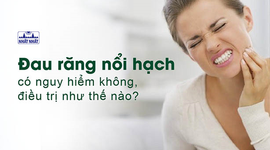 Đau răng nổi hạch có nguy hiểm không, điều trị như thế nào?
