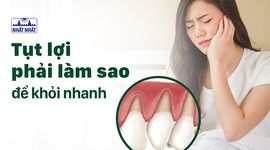 Tụt lợi phải làm sao để khỏi nhanh, bảo vệ răng miệng toàn diện?