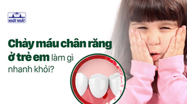 Chảy máu chân răng ở trẻ em làm gì nhanh khỏi?