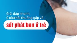 Giải đáp nhanh 9 câu hỏi thường gặp về sốt phát ban ở trẻ