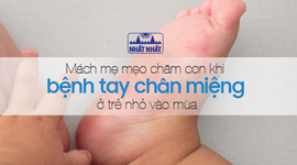 Mách mẹ mẹo chăm con khi bệnh tay chân miệng ở trẻ nhỏ vào mùa