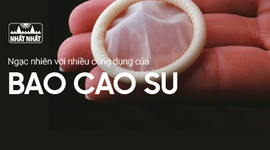 Chắc chắn bạn sẽ ngạc nhiên với nhiều công dụng của bao cao su