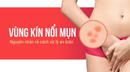 Vùng kín nổi mụn: Nguyên nhân và cách xử lý an toàn