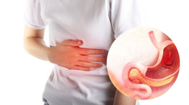 Loét dạ dày triệu chứng cảnh báo cần điều trị ngay!