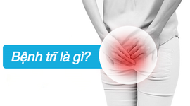 Bệnh trĩ là gì? Giải đáp mọi thắc mắc về bệnh trĩ