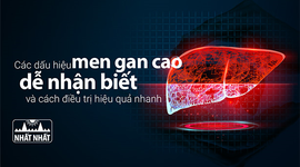Các dấu hiệu men gan cao dễ nhận biết và cách điều trị hiệu quả nhanh