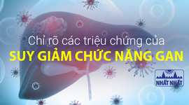 Chỉ rõ các triệu chứng của suy giảm chức năng gan